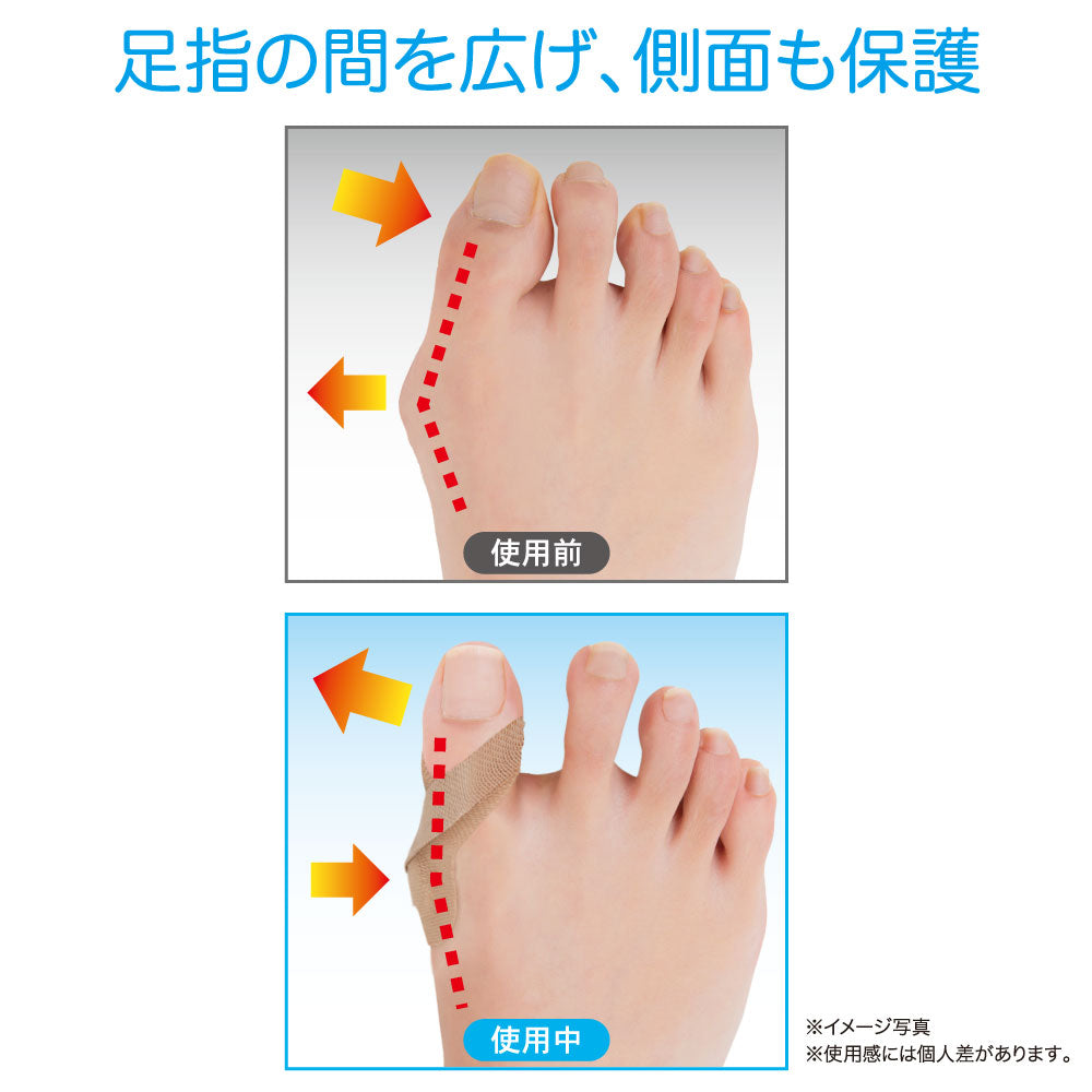 簡単貼るだけ 外反母趾サポートテープ
