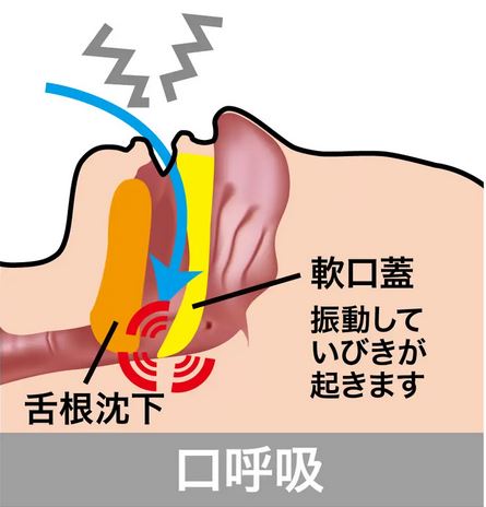 薄型ナイトサイレンサー