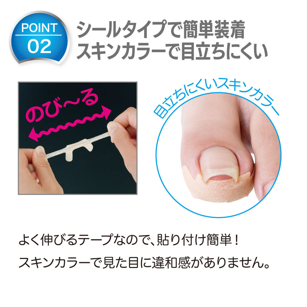 簡単貼るだけ　巻き爪食い込みガードテープ