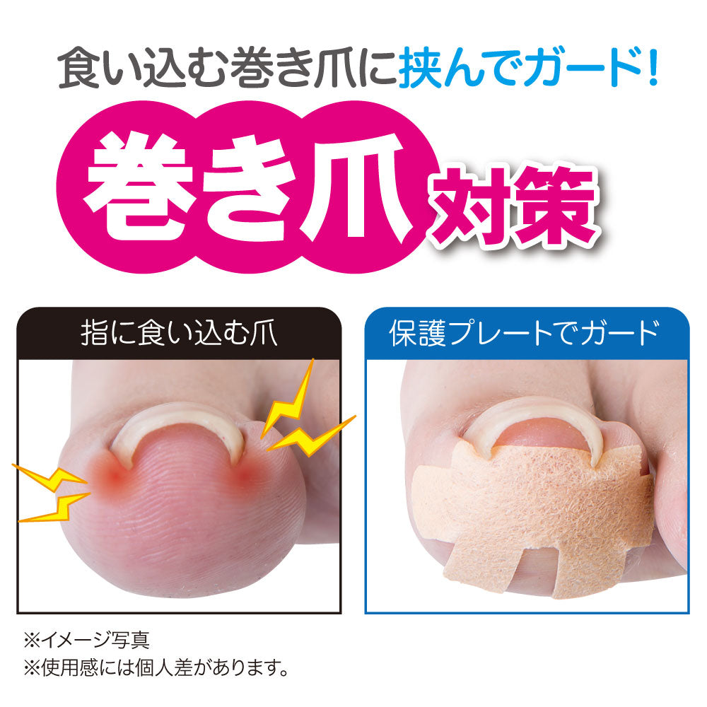 簡単貼るだけ　巻き爪食い込みガードテープ