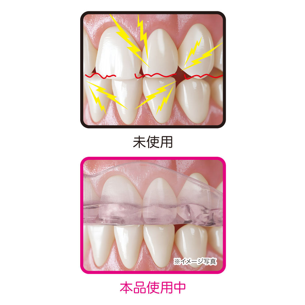 Dr.PRO ナイトマウスピース